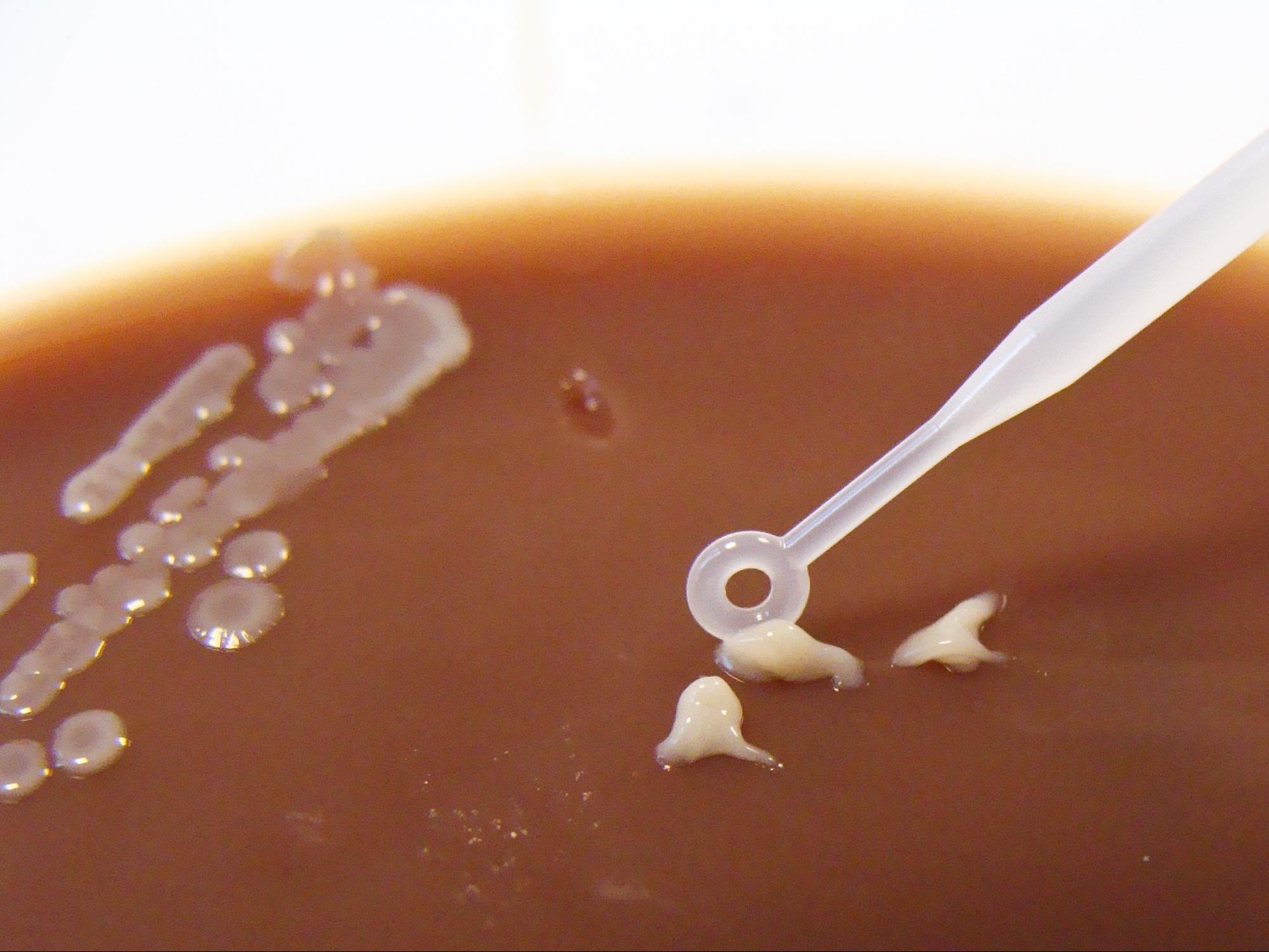 Nathan Reading, Rothia mucilaginosa on Columbia Chocolate Horse Blood Agar, 2012.